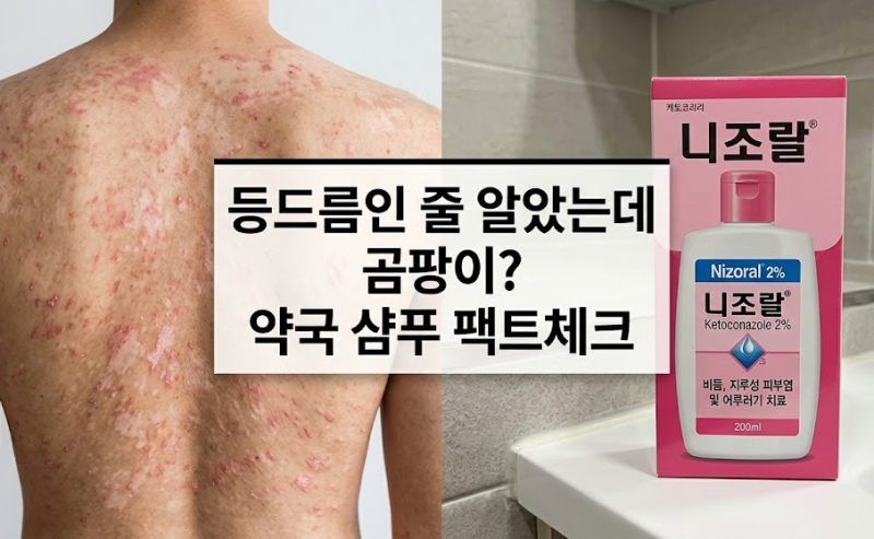등에 오돌토돌 얼룩덜룩한 가려움증? 곰팡이균(어루러기) 잡는 니조랄 샴푸 활용법
