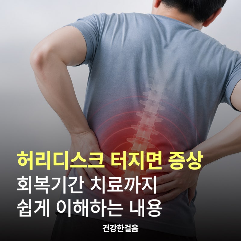 허리디스크 터지면 증상 회복기간 치료까지 쉽게 이해하는 내용