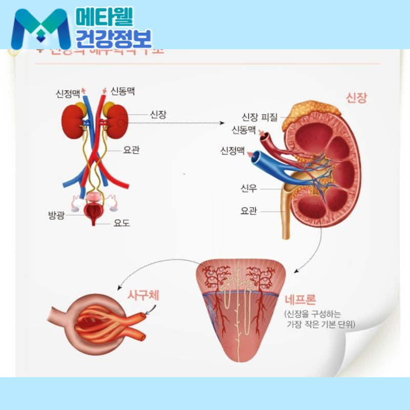 신장암 초기증상과 원인, 치료 방법 그리고 "생존율"은 얼마나 될까