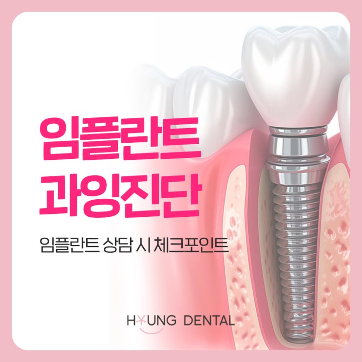  임플란트 과잉진단? 망포역 임플란트 하기 전 조언