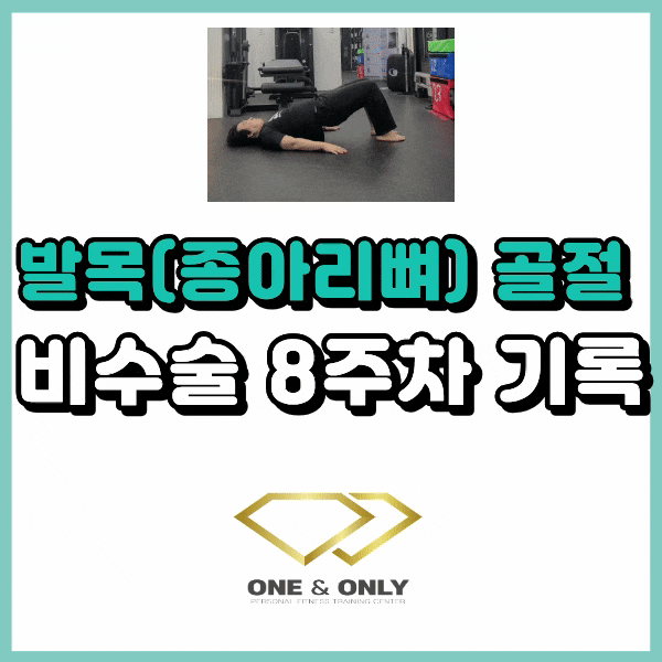 발목 종아리뼈(비골) 골절 8주차 기록 : 목발 없이 걷기 가능할까요?
