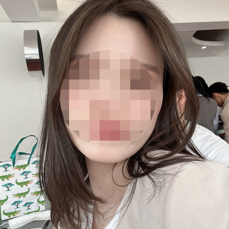 20대 중후반 성인 치아교정 후기ㅣ고통, 기간, 부작용, 교정 중 얼굴형 변화, 못생김, 볼패임, ....