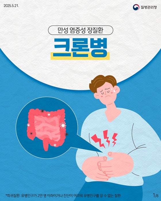 치질인 줄 알았는데 크론병이란 걸 뒤늦게 알았다는 사람들