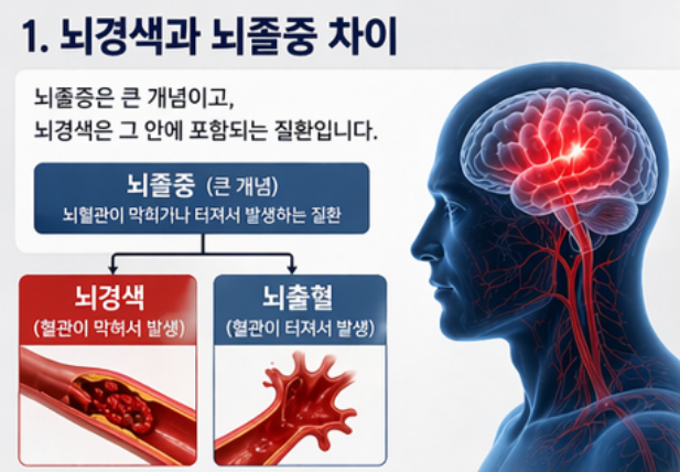 뇌경색 뇌졸중 차이점 총정리 (초기증상·전조증상·예방법 완벽 정리)