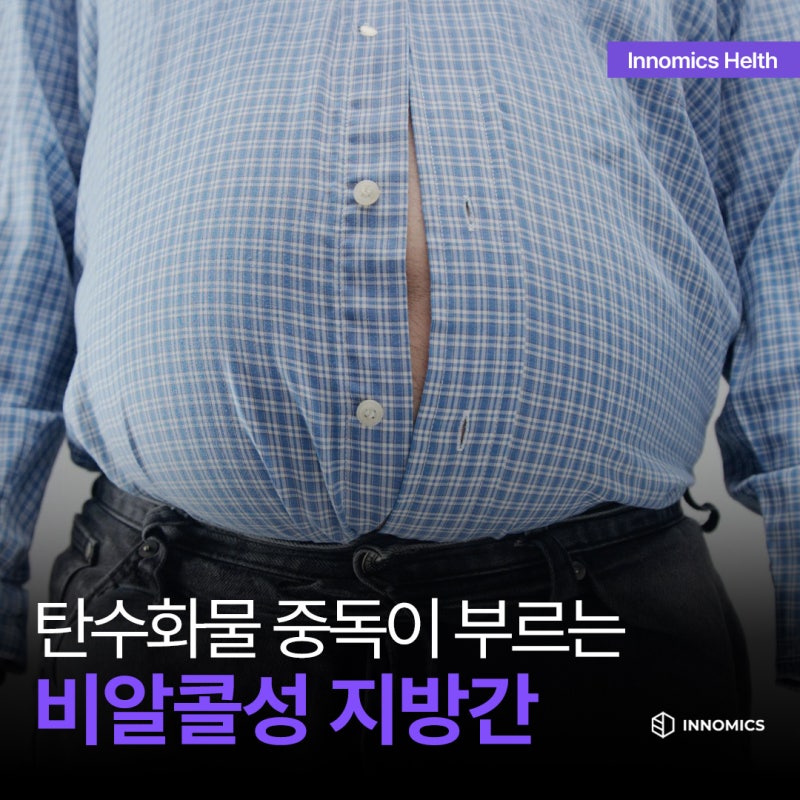 술도 안 마시는데 지방간이라고? 탄수화물 중독이 부르는 비알콜성 지방간 원인과 간수치 팩....