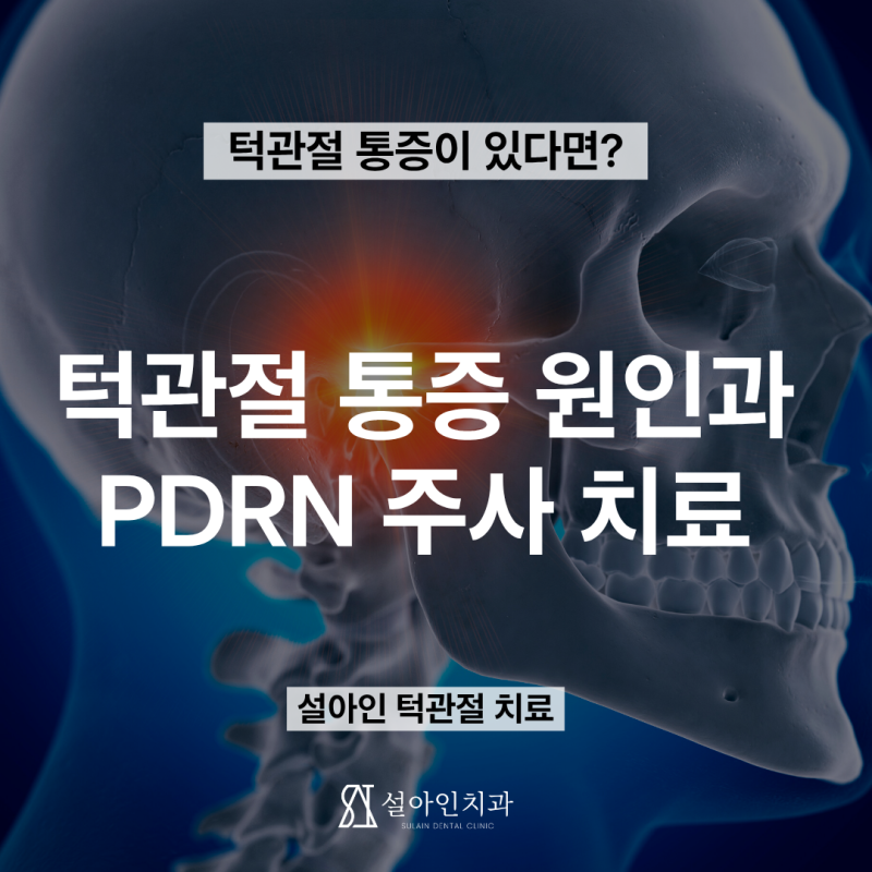 턱관절 통증 원인과 PDRN 프롤로주사 치료 효과 (턱관절 통증 완화부터 조직 재생까지)