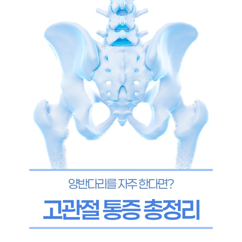 거제장평정형외과: 골반에서 나는 "뚝"소리의 정체, 고관절 3대 주요 질환 총정리!