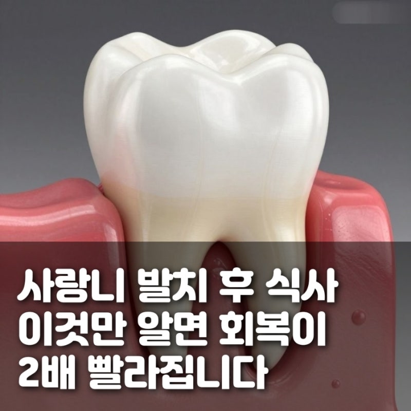 사랑니 발치 후 식사, 이것만 알면 회복이 2배 빨라집니다