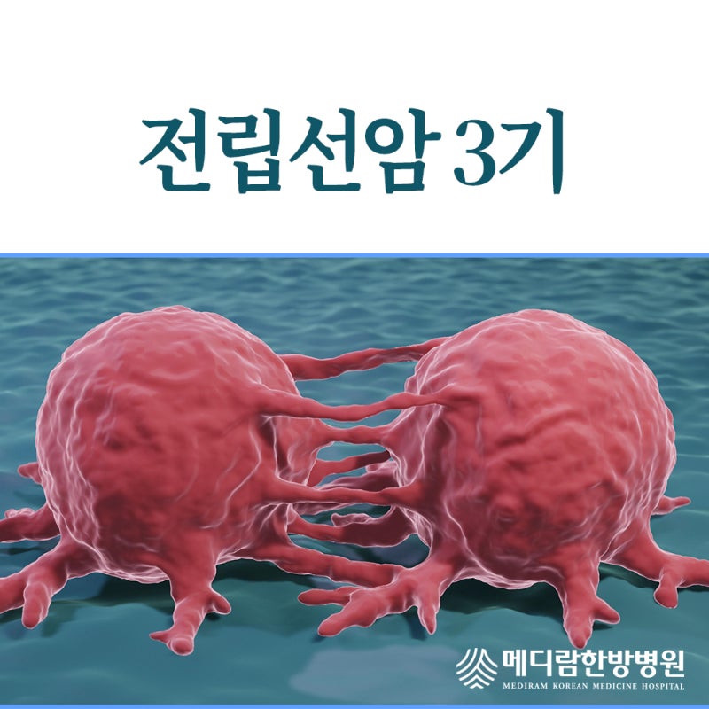 전립선암3기 4기 증상과 생존율