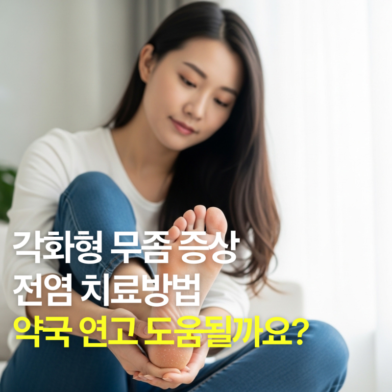 각화형 무좀 증상 전염 치료방법, 약국 연고 도움될까요?