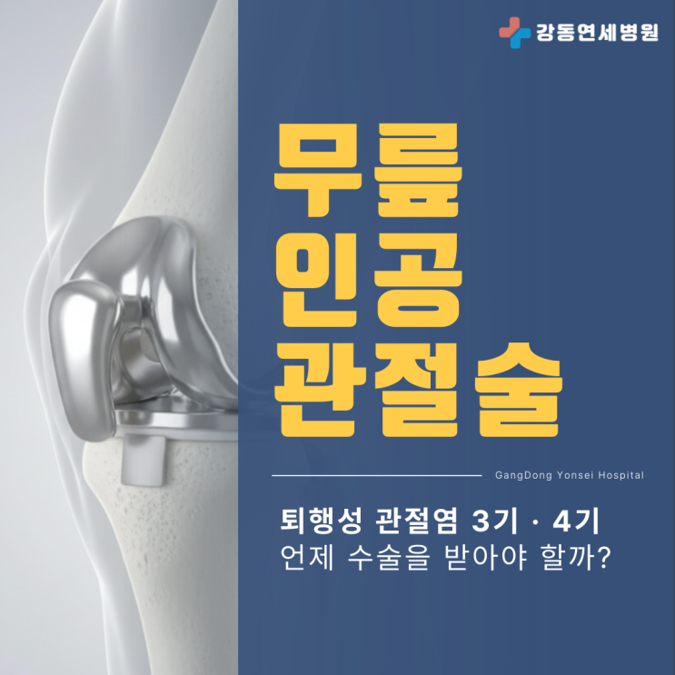  암사동 인공관절수술 무릎 퇴행성관절염 3기 4기 통증, 언제 수술 고려할까?