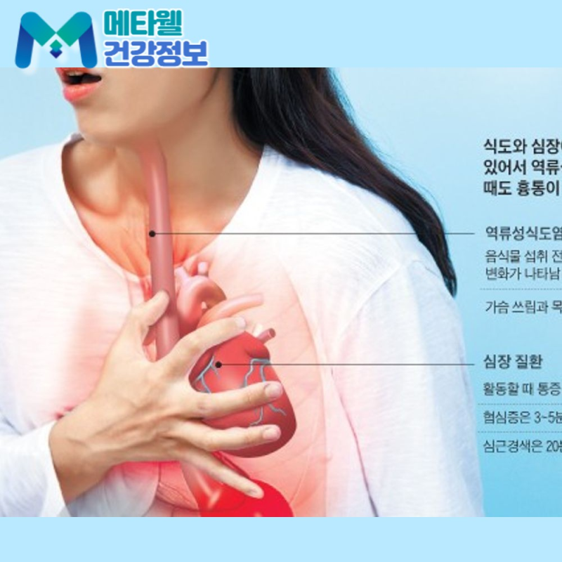 가슴이 콕콕 쑤실 때 심장 문제일까? 왼쪽, 오른쪽 흉통 원인과 대처법