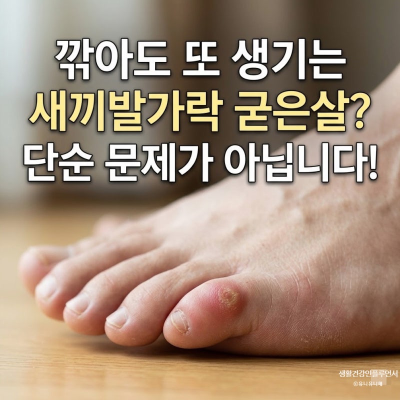 새끼발가락 굳은살과 통증, 신발 문제일까 발가락 변형일까?