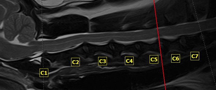 해당 환자의 mri 촬영 영상