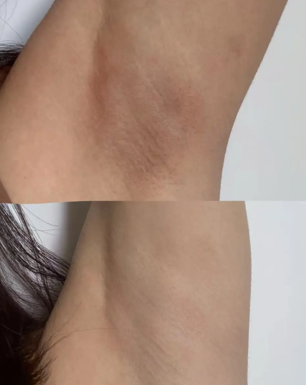  피부착색크림 바르고 민소매 다시 꺼낸 후기