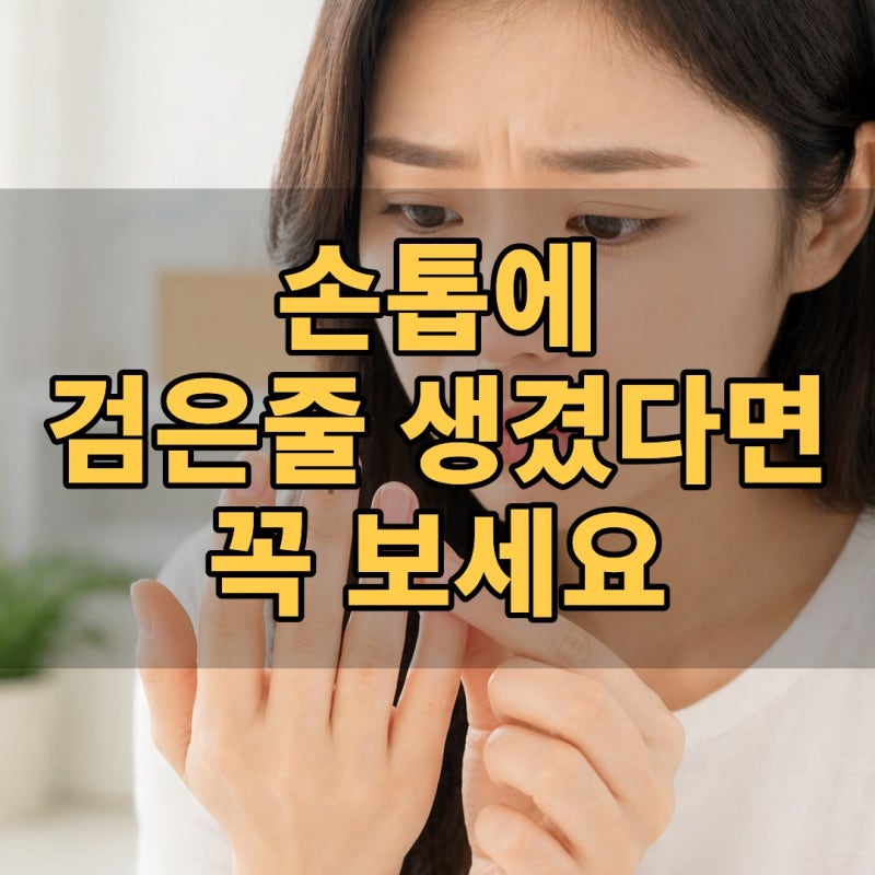 손톱검은세로줄 원인? 손톱 세로줄과 흑색종 증상 구별법 정리