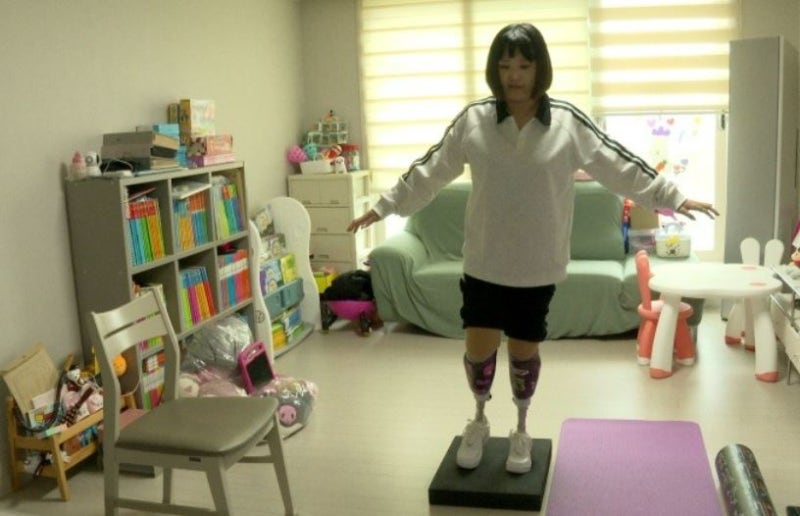 인간극장 나현씨 사고, 화상 이후 두 번째 걸음마