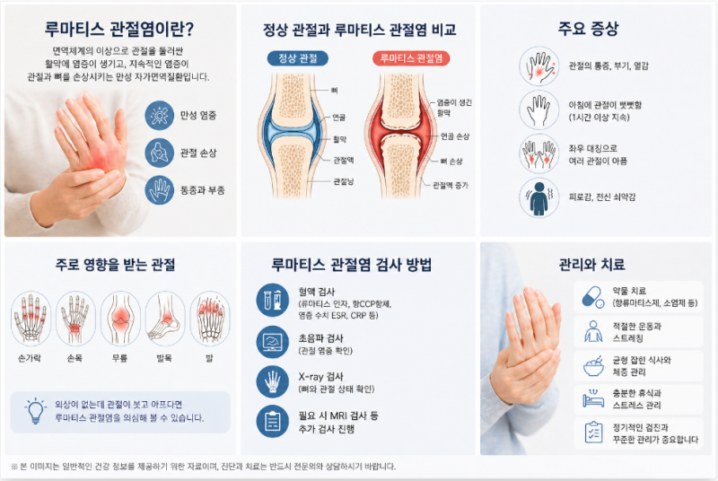 발목 통증으로 병원 다녀온 뒤 알게 된 루마티스 관절염 의심 증상과 검사 과정, 초기 관리 ....