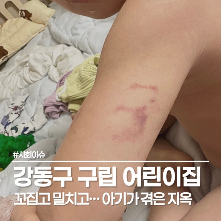  강동구 구립 어린이집 피해 엄마의 호소, 아동학대 탄원서 서명으로 힘을 보태주세요