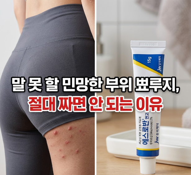 꽉 끼는 레깅스 입고 Y존에 난 뾰루지, 피지낭종일까? 집에서 짜면 절대 안 되는 이유