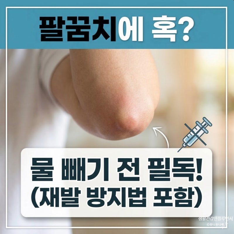 팔꿈치 뒤쪽 부기, 물 빼야 할까? 주두 점액낭염 치료와 재발 방지법