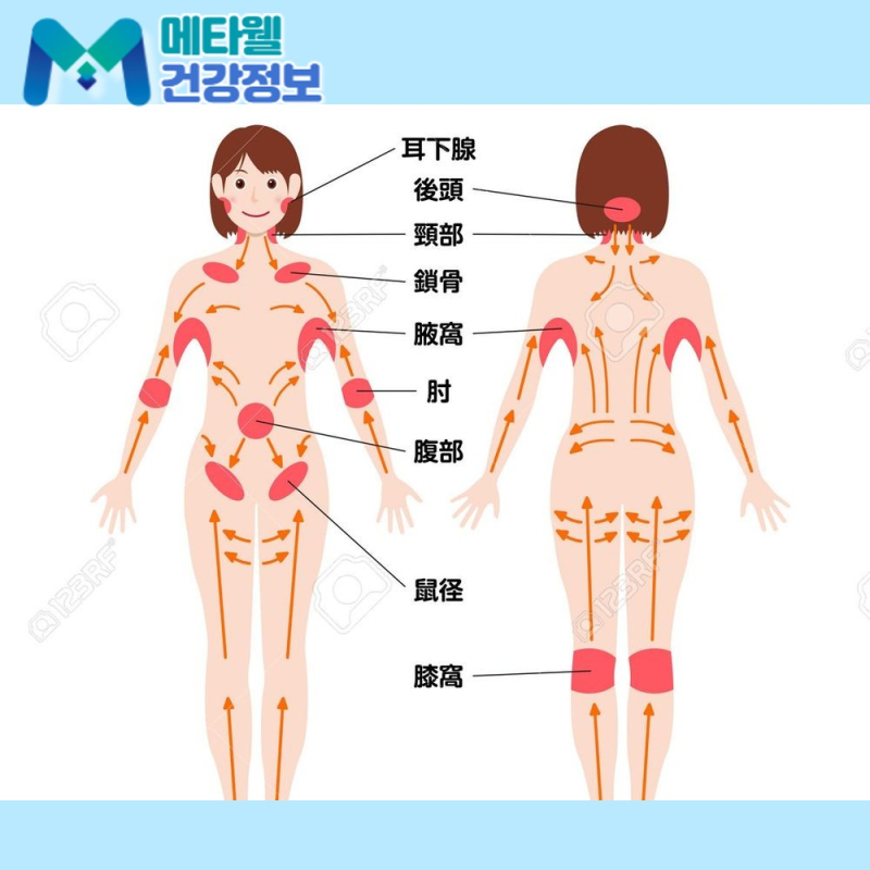 목에 멍울이 만져진다면? 림프종 증상과 원인, 검사, 치료법