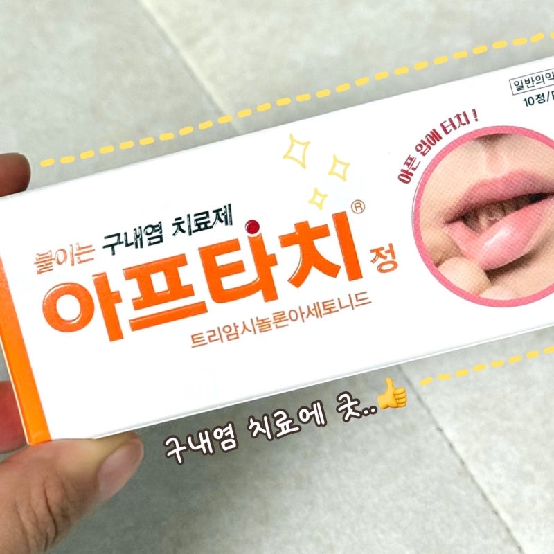 구내염 맨날 나는 사람의 붙이는 구내염 치료제 아프타치 사용방법 및 주의사항 정리