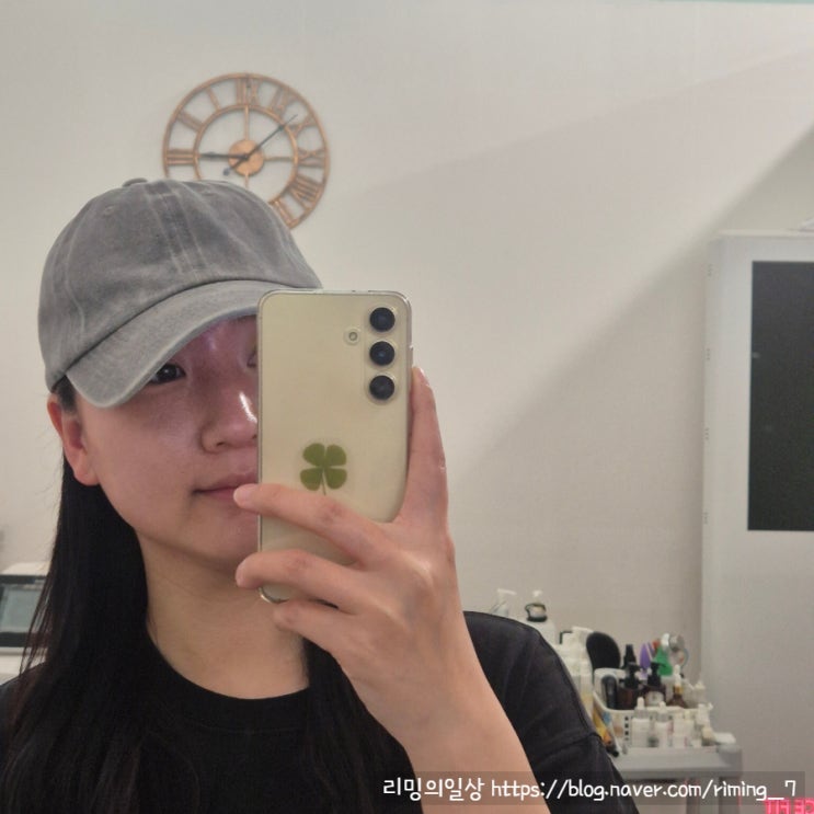  부산 정관 피부관리 에스테틱썬플 비대칭 관리