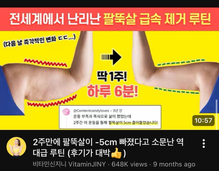  [웨딩] 드레스핏 관리 시작｜웨딩촬영 2주 전 팔뚝살 운동 기록