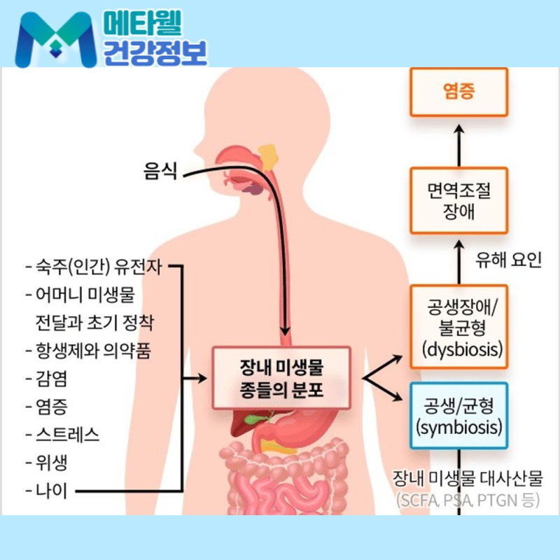 반복되는 혈변과 복통, 궤양성 대장염의 증상과 치료 방법