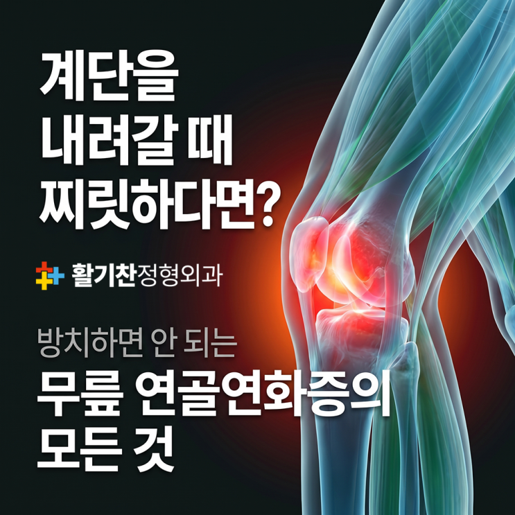  계단 내려갈 때 무릎 통증? 연골연화증 의심하세요