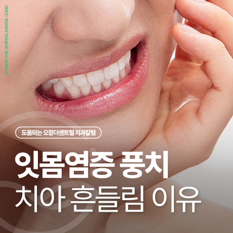 잇몸 염증 고름 풍치 뜻 치아 흔들리는 이유?
