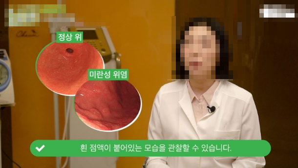 위축성위염치료 영양제 추천 유익균 효과까지 고르는 법