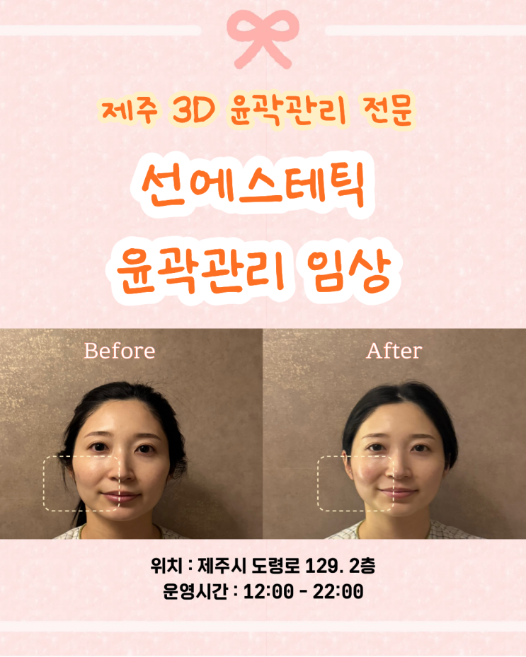  제주 웨딩관리 체형관리 전문, 선에스테틱