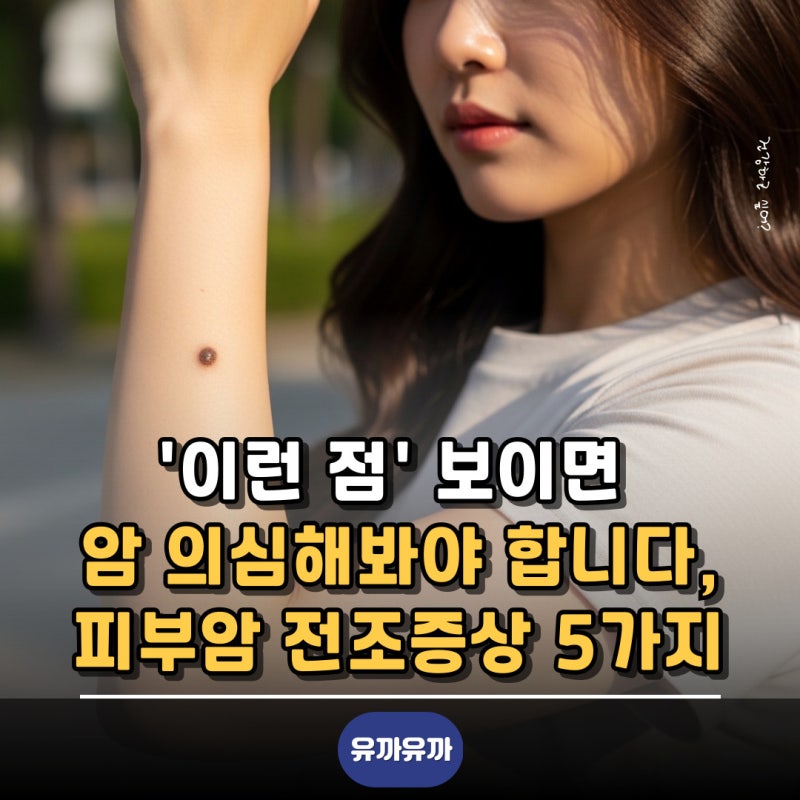 '이런 점' 보이면 암 의심해봐야 합니다, 피부암 전조증상 5가지
