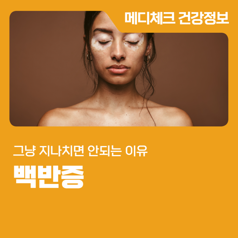 백반증 그냥 지나치면 안 되는 이유