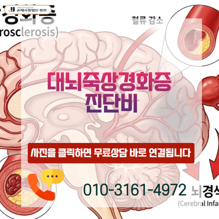  대뇌죽상경화증 진단비, 협착 50 % 미만인데 거절됐다면 반드시 보세요