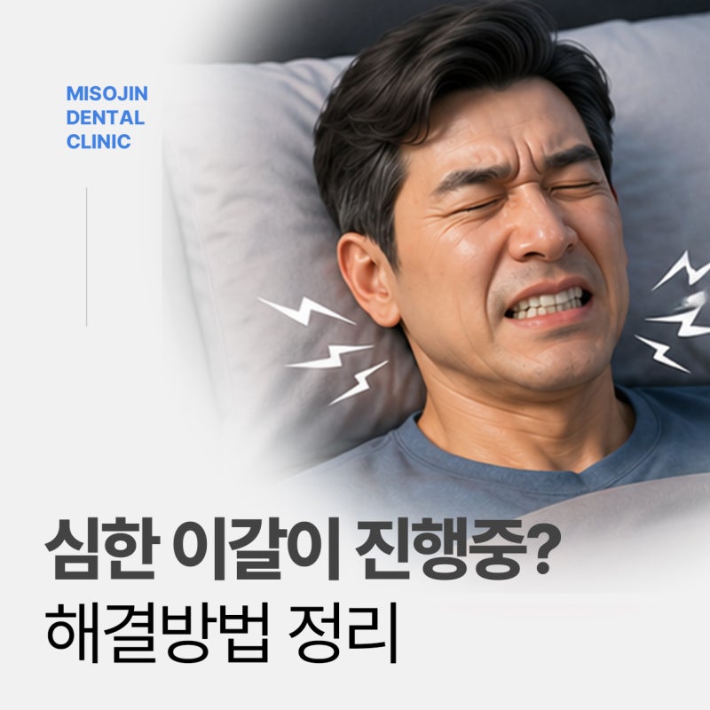이갈이 스플린트 장치 해결 방법