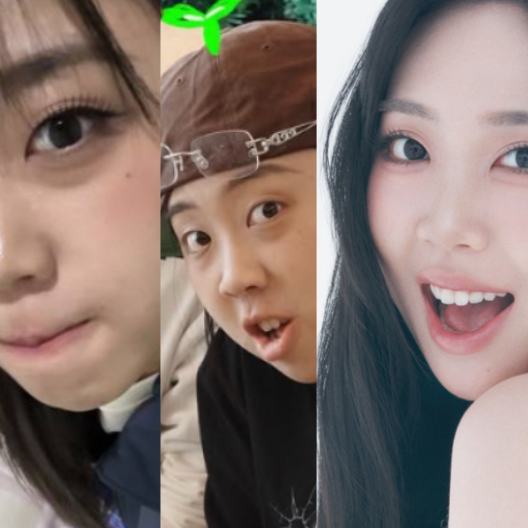 "Is That Lee Young-ji?" Before & After Under-Eye Fat Repositioning After 4 Years of Deliberation... Her Candid Thoughts on Her 'Last Surgery' (ft. Cost/Review)