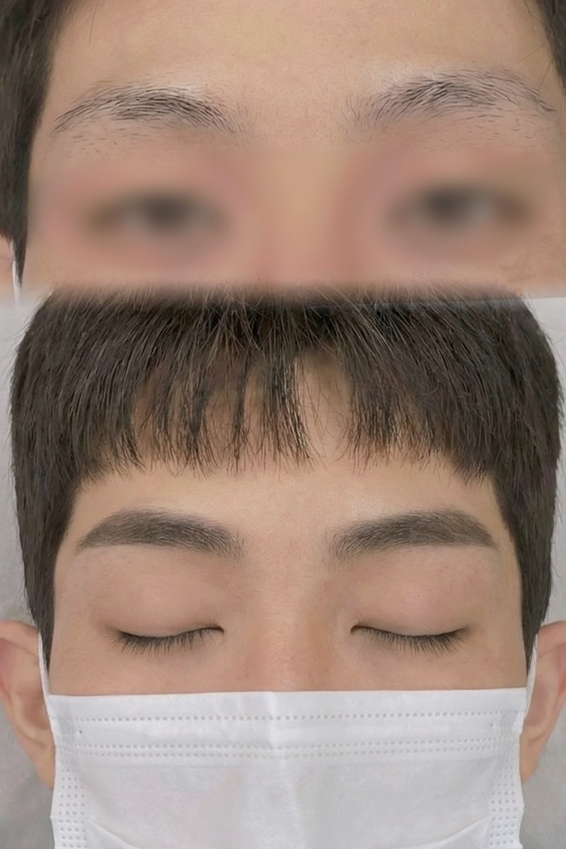 사진 7