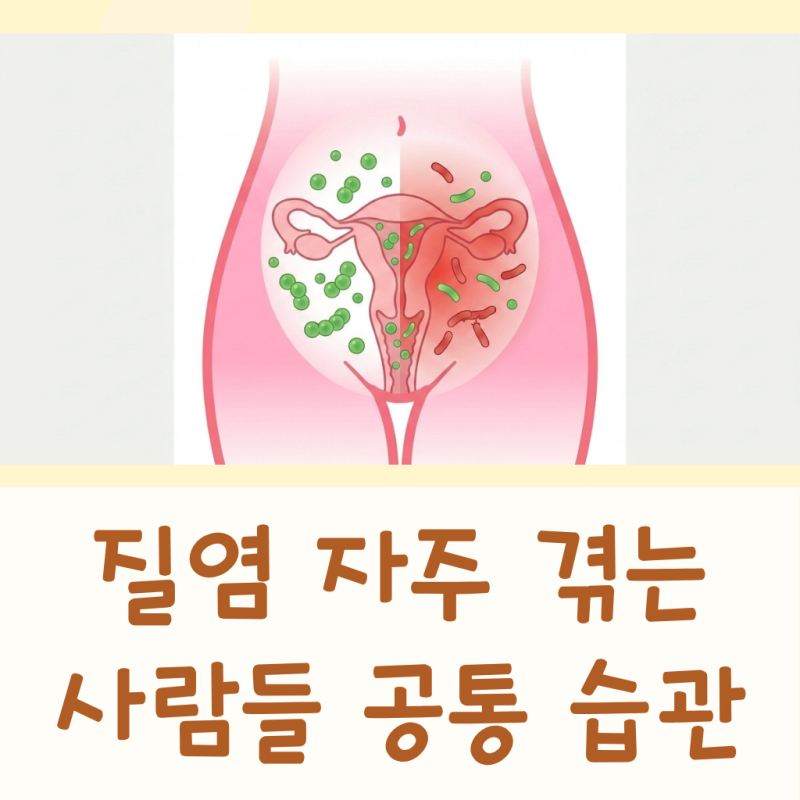 칸디다 질염 증상 약 종류 원인 약국약 치료 가드넬라 질염 세균성 질염