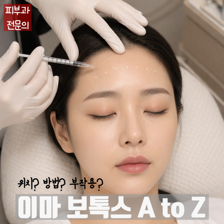  논문기반 이마 보톡스 리뷰! 위치, 방법, 부작용(안검하수/눈썹하수/미간두드러짐/눈꺼풀부종)