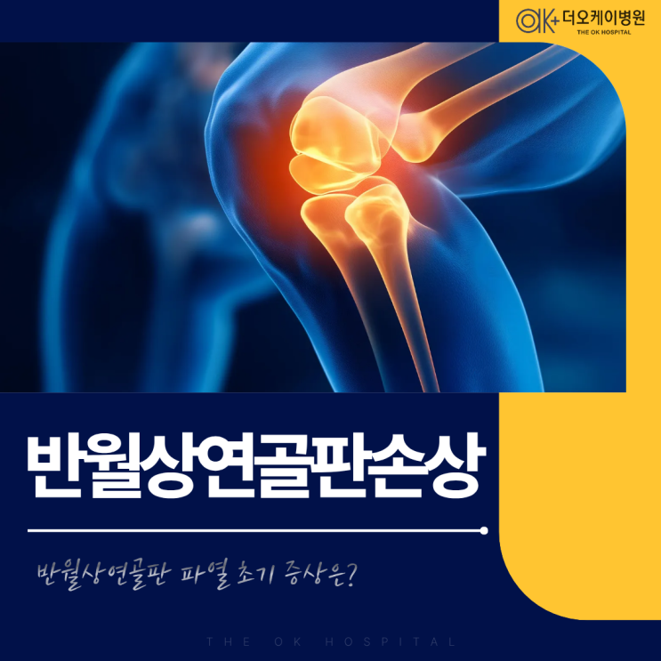  춘천 무릎 연골판 손상, 반월상연골판 파열 초기 증상은?