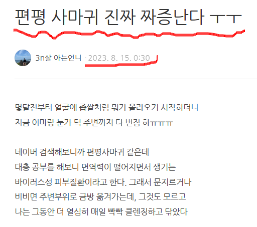 3년간의 편평사마귀 완치후기 & 재발방지 노하우 (면역력 올리는 생활습관/존스랩 프로폴리....