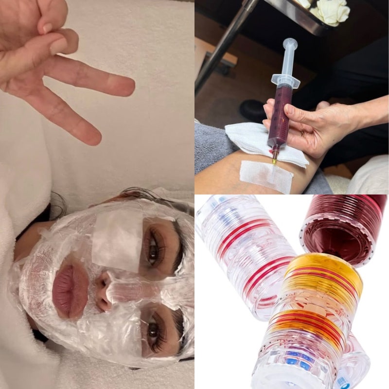 킴카다시안도 받았다는 줄기세포 노바스템 예약하고 왔어요! 30대 40대 피부관리 피부탄력 시....