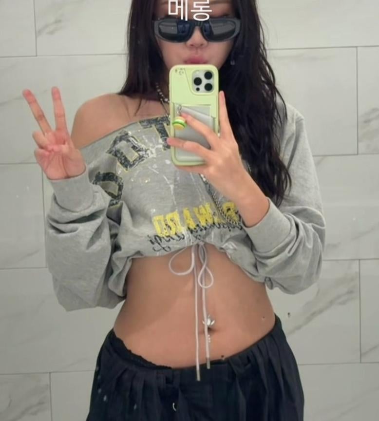 "Because they kept asking if I was tired" Lee Young-ji's Reason for Wearing Sunglasses at Seventeen Concert After Under-Eye Fat Repositioning