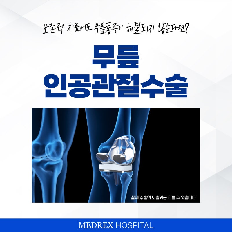 인공관절수술명의가 알려주는 퇴행성관절염과 치료 방법