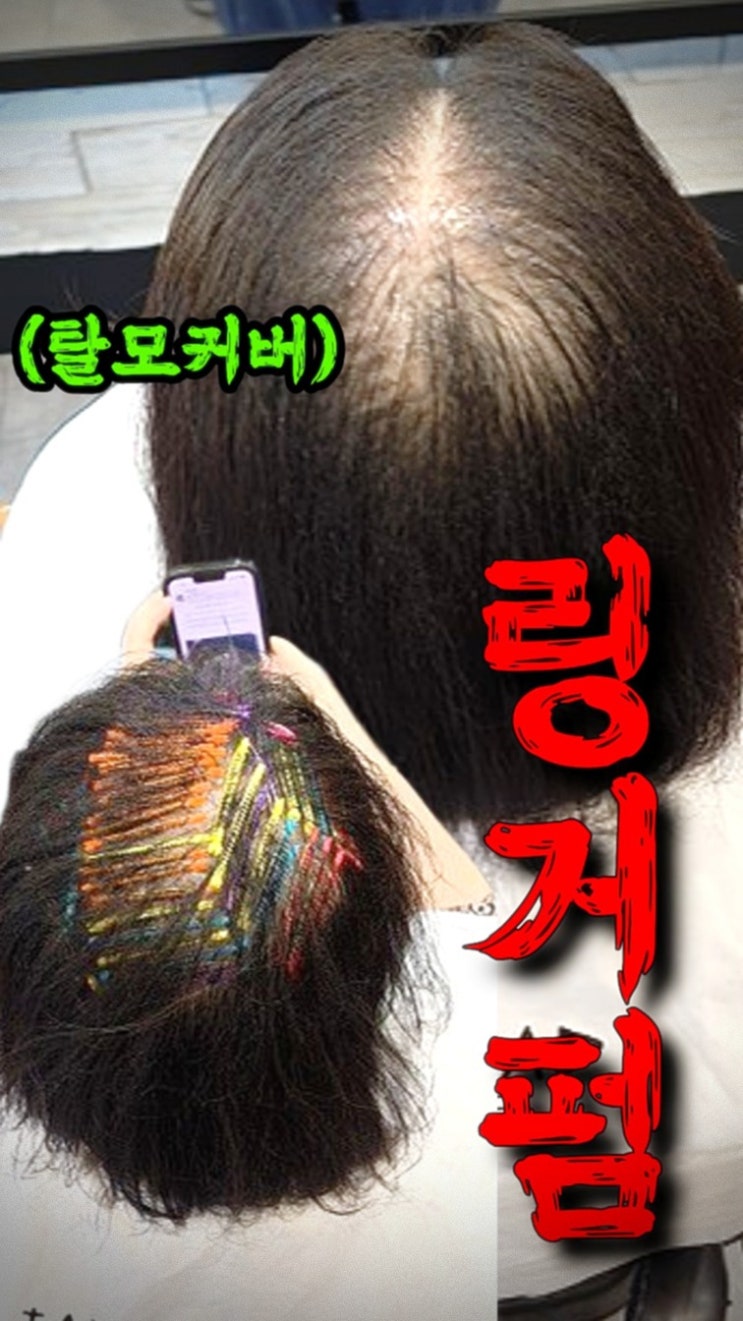  성수동 모류교정 링거펌 찾다가 결국 수원까지 온 이유 (정수리 고민 해결 후기)