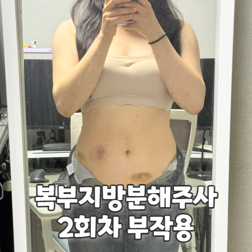  복부지방분해주사종류에 따른 효과 차이와 부작용 포함 2회차 후기