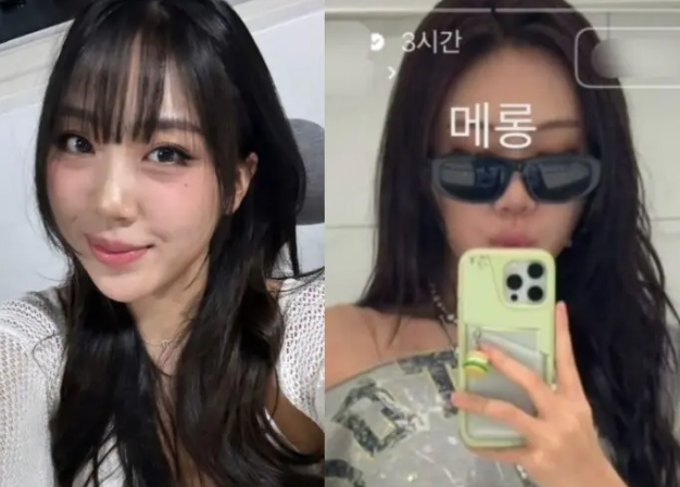 이영지, 4년 고민 끝 눈밑지방 수술 — 직접 공개한 전후 비교, 이 정도일 줄 몰랐다